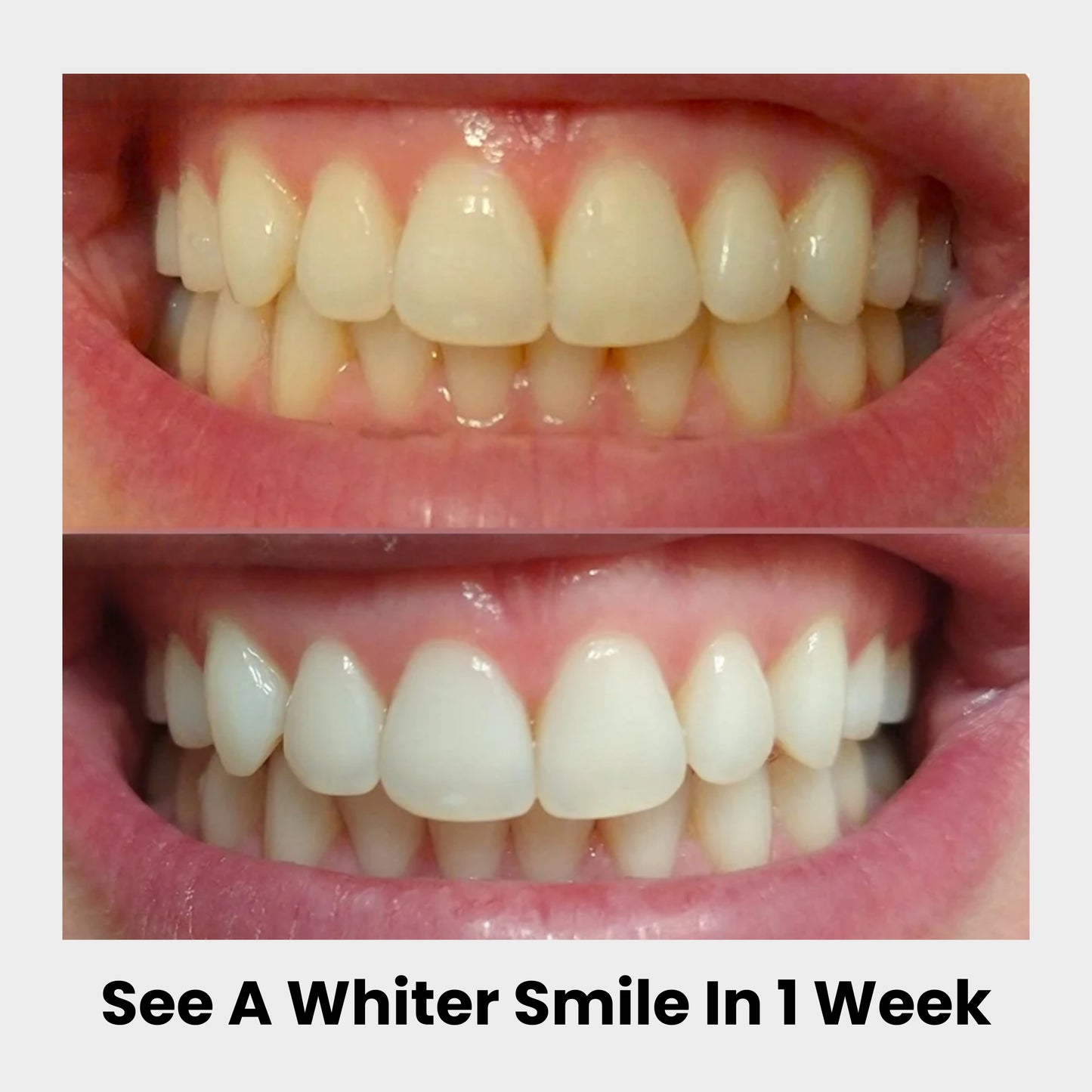 ACTVN - PAP+ Whitening Teeth Strips